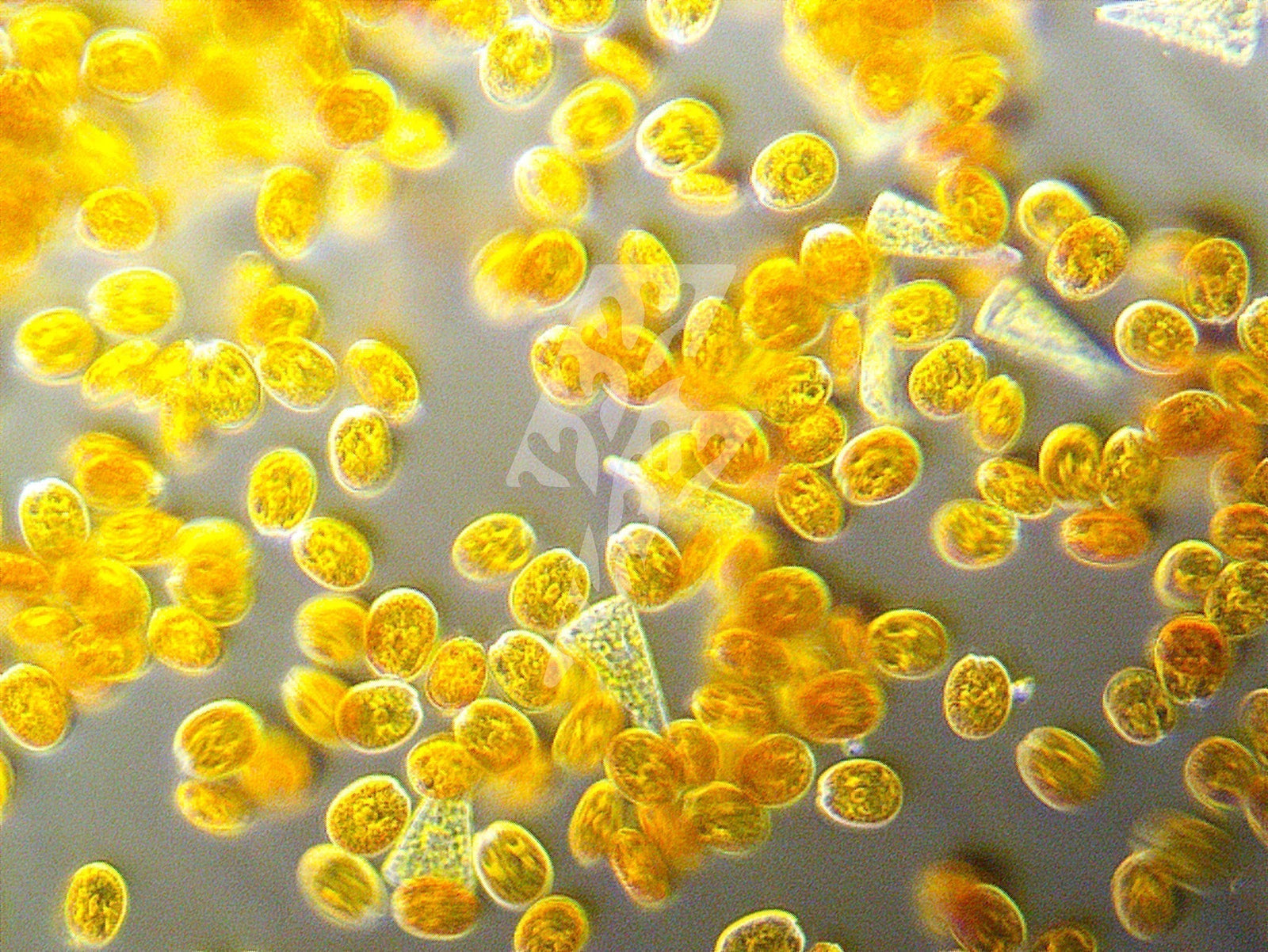 How to Identify and Eliminate Dinoflagellates (Dinos) in Reef Aquariums